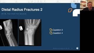 Fundamentals of Orthopaedics Session 16 - Hands