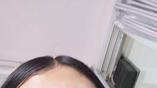 skin rejuvenation
