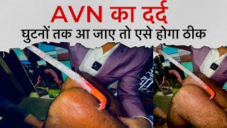 AVN Pain Referred From Hip To Knees | Dr Amit Bharti Avn spine & Joints Specialist