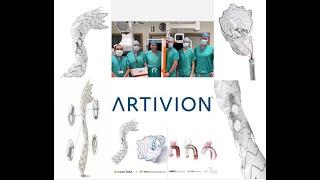 Launch of First Artivion-iBevar-E-nside TAAA Endograft  at Galway University Hospital, Ireland