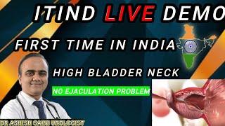 iTIND for High bladder neck live demonstration first time in India