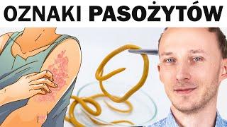 Objawy, że pasożyty grasują w jelitach. Jak je wygonić?