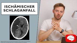 Ischämischer Schlaganfall - Grundlagen der Neurologie