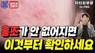 홍조 민감성피부 계속 된다면 이 영상을 꼭 확인하세요! - 피부과전문의 닥터피부광