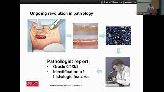 Vijaya B. Kolachalama: Digital Pathology and Spatial Biology: Opportunities for Machine Learning