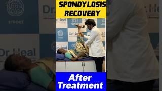 Spondylosis Recovery After Treatment #yt #ytshorts #motivation #doctor