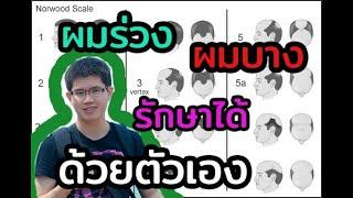 วิธีรักษา ผมร่วง ผมบาง ศรีษะล้าน l 10นาทีกับหมอต่อ