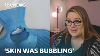 'More painful than childbirth': Burns from hot water bottles double in last five years | ITV News