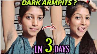 Get Rid of Dark Armpits NATURALLY  100% Works in 3 DAYS