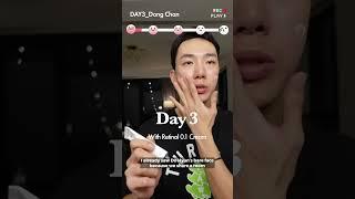 [Skin Diagnosis Test] Revealed the REAL RESULTS after 4 weeks with Retinol 0.1 Cream!