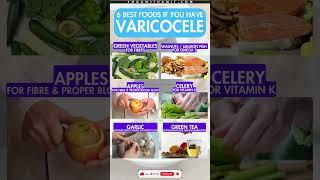 6 Best Foods for Varicocele