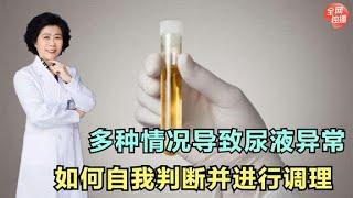 尿液發黃發臭，到底只是單純的上火，還是身體出了什麼問題？ #全科醫生 #中醫 #養生