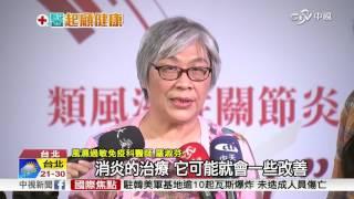 類風濕關節炎年輕化! 不痛就停藥恐關節變形│中視新聞 20160519