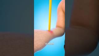 Stabbed With A Pencil: ER Or Not?  - Melon Playground #pencil