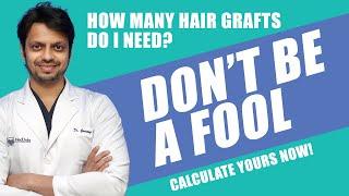 {2024} How Much GRAFTS You Need For Hair Transplant | हेयर ट्रांसप्लांट में आपको कितने ग्राफ्ट चाहिए