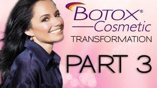 BOTOX Transformation - PART 3 - Janet Jenkins - Dr. Lisa Airan