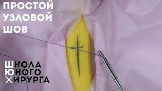 простой узловой шов (техника; как наложить)