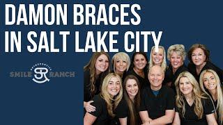 Damon Braces In Salt Lake City