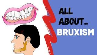 All About Bruxism