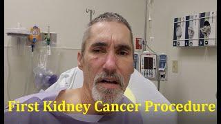 Back Home from my first Kidney Cancer Procedure (My Journey has begun)