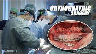 Orthognathic Double jaw Surgery (before and after) Behind scenes.