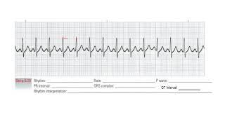 SINUS Rhythm REVIEW 2020