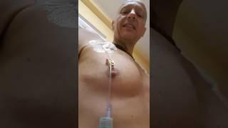 How to put on venous port