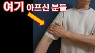 팔 통증 (상완부) - 통증의 원인은 팔이 아닙니다. (feat. 어깨통증)