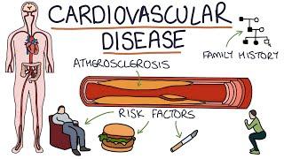 Understanding Cardiovascular Disease: Visual Explanation for Students