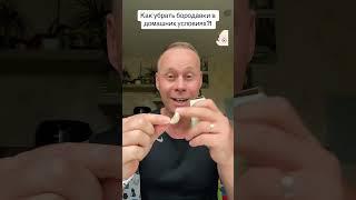 Как убрать бородавки в домашних условиях?!￼ #лайфхаки #здоровье #обучение #советы #bobbygrant690