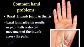 Hand Pain ,Fingers pain - Everything You Need To Know - Dr. Nabil Ebraheim