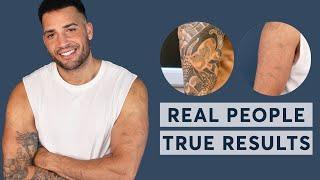 Laser Tattoo Removal  |  Real People, True Results 2023