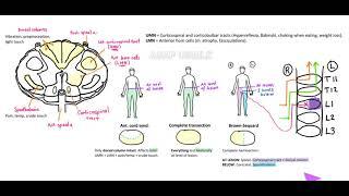 Spinal cord lesions, Spinothalamic tract, UMN and LMN, Brown-Sequard. As easy as it gets!