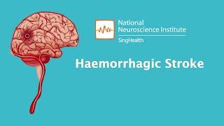 Understanding Stroke: Haemorrhagic Stroke - What's going to happen?