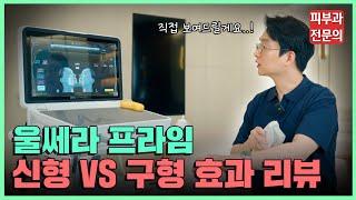 신형 울쎄라 프라임의 귀환! 신형과 구형의 특징 및 차이점을 비교 해드립니다