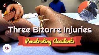 Three Bizarre Accidental Injuries