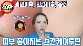 [04] 피부 완전히 뒤집어 졌을때, 너무 예민해졌을때 꼭 필요한 스킨케어 루틴 추천 Easy and fast 3 ways to improve your skin