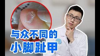 小脚趾甲又厚又丑？裂成两瓣？皮肤科医生告诉你原因