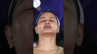 ஆரோக்கியமான மற்றும் மென்மையான முக பொலிவு பெற#skincaretips#cupping#halinacupping#chennai#tnagar