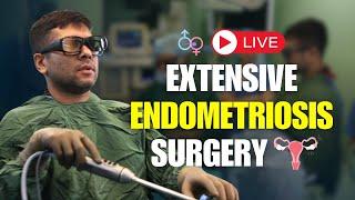  LIVE Extensive Endometriosis Surgery Video | In Hindi | Dr Jay Mehta Mumbai