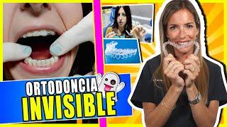 Como se pone la 𝗢𝗥𝗧𝗢𝗗𝗢𝗡𝗖𝗜𝗔 𝗜𝗡𝗩𝗜𝗦𝗜𝗕𝗟𝗘 , descubre como tener los dientes 𝗔𝗟𝗜𝗡𝗘𝗔𝗗𝗢𝗦 𝗦𝗜𝗡 𝗕𝗥𝗔𝗖𝗞𝗘𝗧𝗦