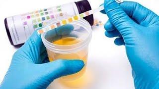 urine R/E examination|| urinalysis||urine physical, chemical and microscopic examination||