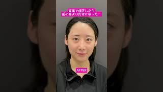 今の鼻が気に入らないなら#東京美容外科 #鼻整形 #他院修正