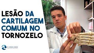 LESÃO CONDRAL E OSTEOCONDRAL DO TALUS: Sintomas, diagnóstico e tratamento