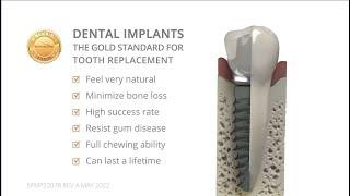 BioHorizons Dental Implant Tooth vs. Natural Tooth Patient Animation