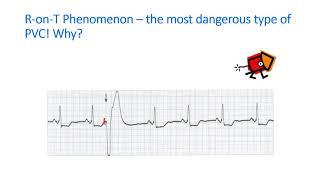 VENTRICULAR 2020 video