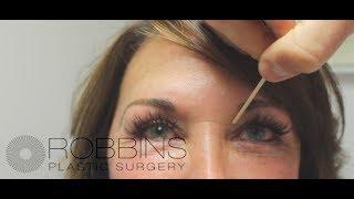 EYELID SURGERY- Award-Winning Nashville Plastic Surgeon Dr. Chad Robbins