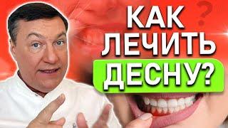 Как лечить ВОСПАЛЕНИЕ десны в домашних условиях? Гингивит и пародонтит.