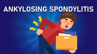 What is Ankylosing Spondylitis? | Arthritis That Fuses Your Bones