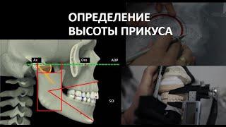 ОПРЕДЕЛЕНИЕ ВЫСОТЫ ПРИКУСА И ГИПСОВКА В НОЛЬ